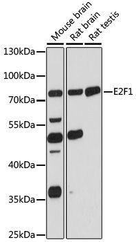 Western blot
