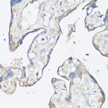 Immunohistochemistry - CASP3 Polyclonal Antibody (144-02156)
