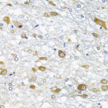 Immunohistochemistry - DDX39A antibody (144-07955)