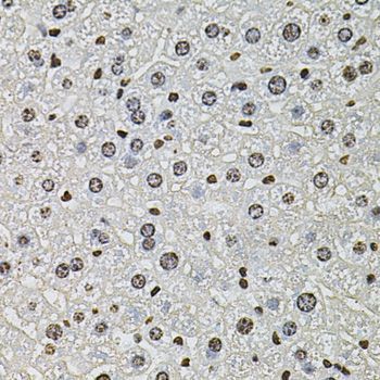 Immunohistochemistry - H2AFZ antibody (144-06614)