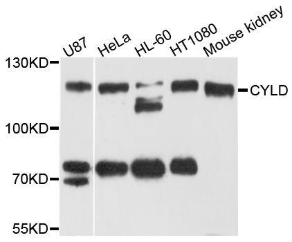 Western blot - CYLD antibody (144-03821)