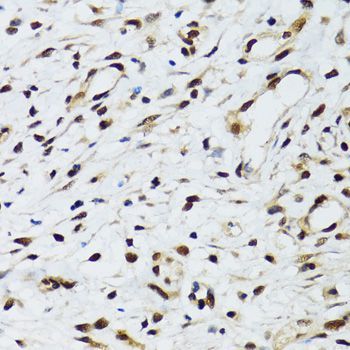 Immunohistochemistry - FLI1 Polyclonal Antibody (144-05644)