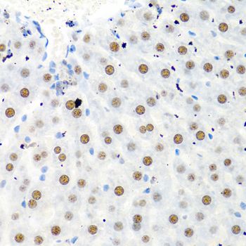 Immunohistochemistry - PTBP1 antibody (144-06107)
