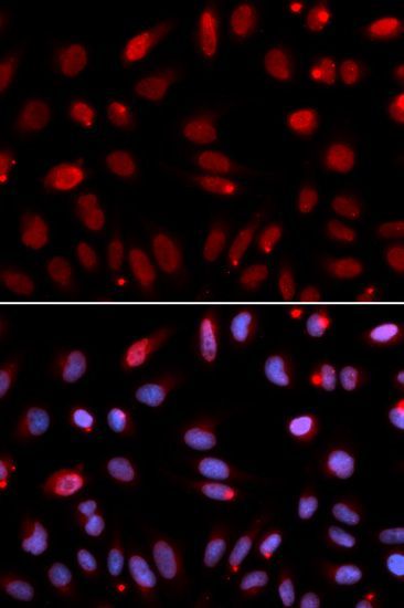 Immunofluorescence - HUS1 Polyclonal Antibody (144-05407)