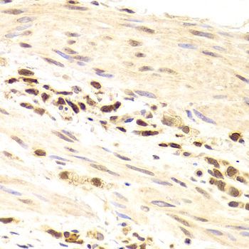 Immunohistochemistry - PRPF3 Polyclonal Antibody (144-05482)