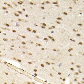 Immunohistochemistry - CBX8 Polyclonal Antibody (144-06222)