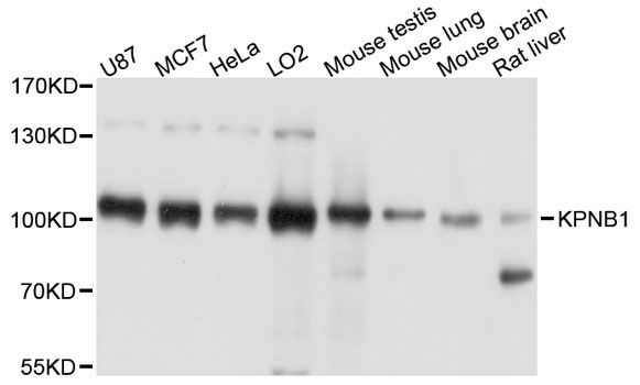 Western blot - KPNB1 Polyclonal Antibody (144-08610)