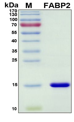 SDS-PAGE