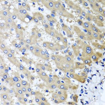 Immunohistochemistry - RBP2 antibody (144-06717)