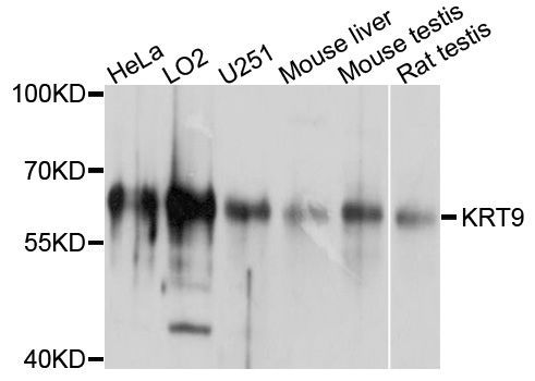 Western blot - KRT9 Polyclonal Antibody (144-600509)