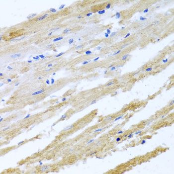 Immunohistochemistry - BNIP3 Polyclonal Antibody (144-05683)