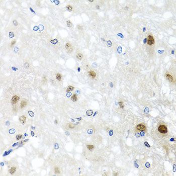 Immunohistochemistry - SAFB2 antibody (144-04330)