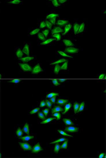 Immunofluorescence - CPT1A Polyclonal Antibody (144-05307)