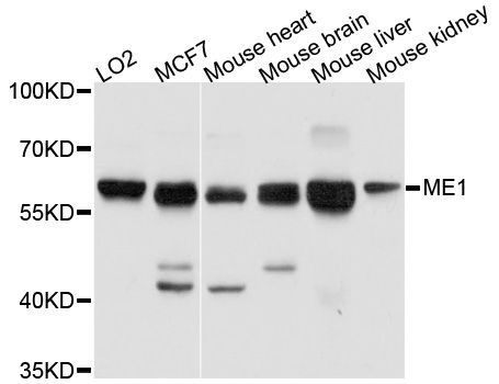 Western blot - ME1 antibody (144-03956)