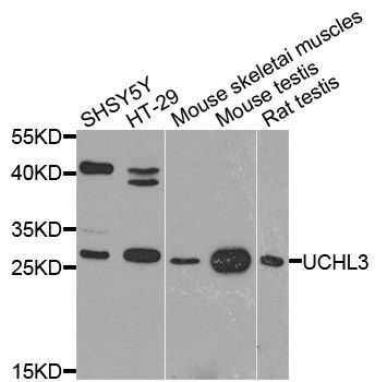 Western blot - UCHL3 antibody (144-08156)