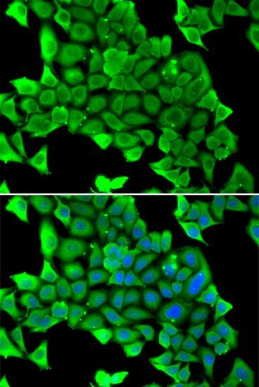 Immunofluorescence - MYH1 antibody (144-06935)