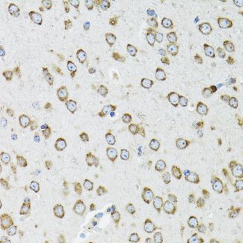 Immunohistochemistry - OGDH antibody (144-012477)