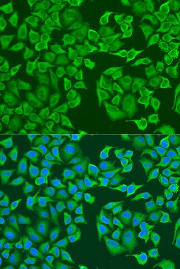 Immunofluorescence - IGF2BP3 antibody (144-61435)