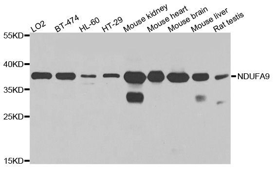 Western blot - NDUFA9 antibody (144-03196)
