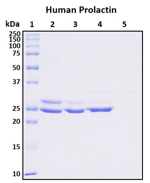 SDS-PAGE