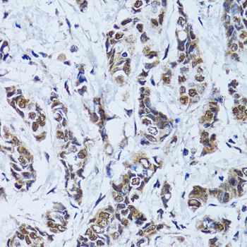Immunohistochemistry - TP53BP1 antibody (144-05757)