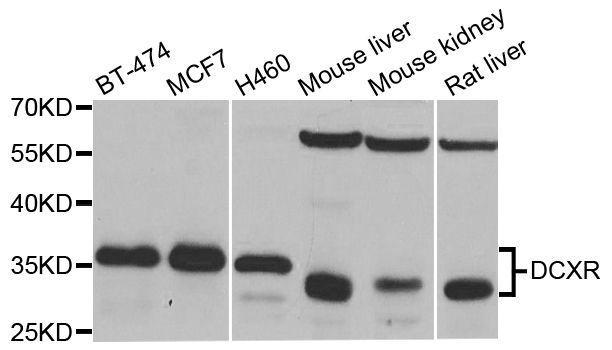 Western blot - DCXR antibody (144-04721)