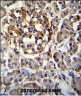 IHC-P