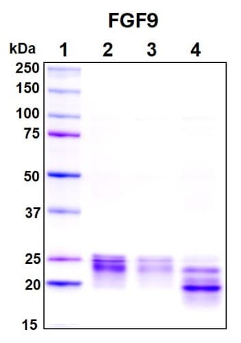 SDS-PAGE Image