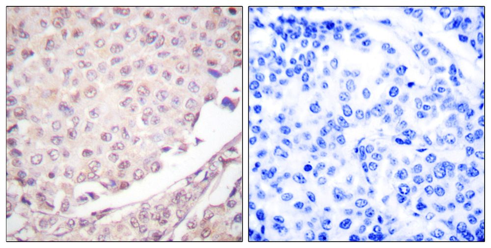 IHC