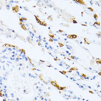 Immunohistochemistry - SFTPC antibody (144-01835)