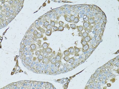 Immunohistochemistry - PSMF1 antibody (144-05554)