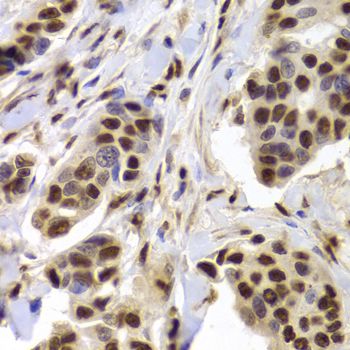 Immunohistochemistry - XRCC5 Antibody (144-05862)