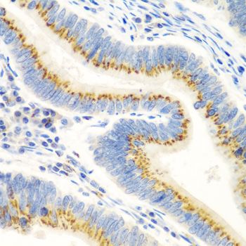 Immunohistochemistry - UBIAD1 antibody (144-07640)
