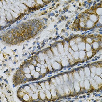 Immunohistochemistry - AK1 Polyclonal Antibody (144-603440)