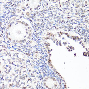 Immunohistochemistry - Phospho-Stat3-Y705 pAb (144-50070)