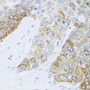 Immunohistochemistry - [KO Validated] CHD1 Polyclonal Antibody (144-07883)