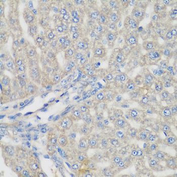 Immunohistochemistry - METTL7A antibody (144-08201)
