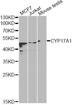 Western blot - CYP17A1 Polyclonal Antibody (144-01373)