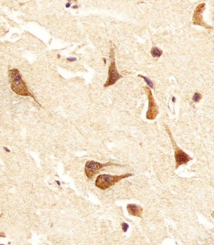 IHC-P