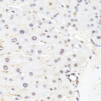 Immunohistochemistry - Phospho-Stat3-Y705 pAb (144-50070)