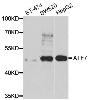 Western blot - ATF7 antibody (144-07580)