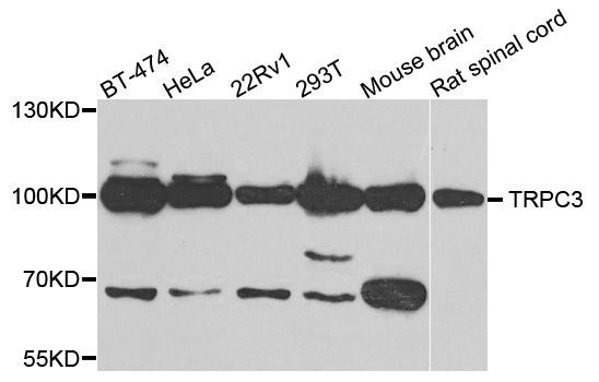 Western blot - TRPC3 antibody (144-07742)