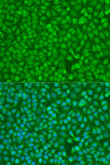 Immunofluorescence - CHEK1 Polyclonal Antibody (144-07653)
