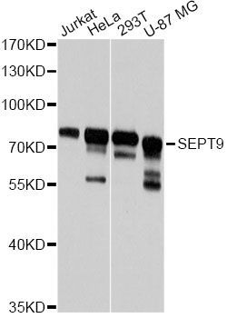 Western blot - SEPT9 Polyclonal Antibody (144-08657)