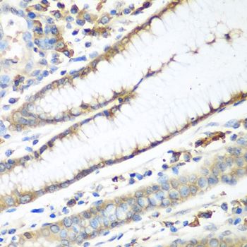 Immunohistochemistry - CAD antibody (144-08344)