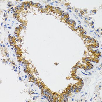 Immunohistochemistry - CHMP4B antibody (144-07402)