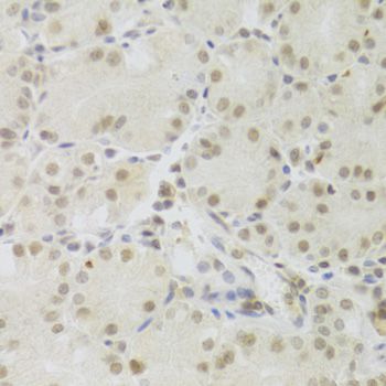 Immunohistochemistry - PRPF3 Polyclonal Antibody (144-05482)