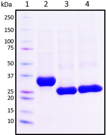 SDS-PAGE
