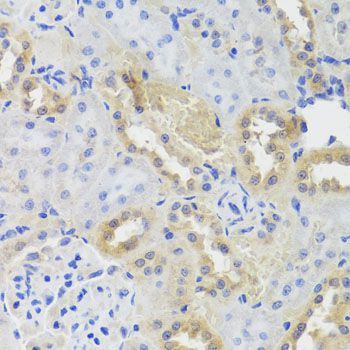Immunohistochemistry - CTSC antibody (144-08403)