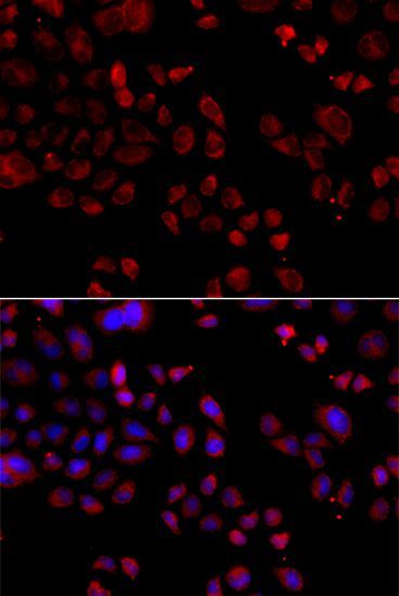 Immunofluorescence - SLC22A11 antibody (144-07816)